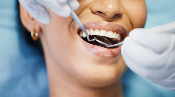 Best Emergency Root Canal Treatment in Huntsville, AR
